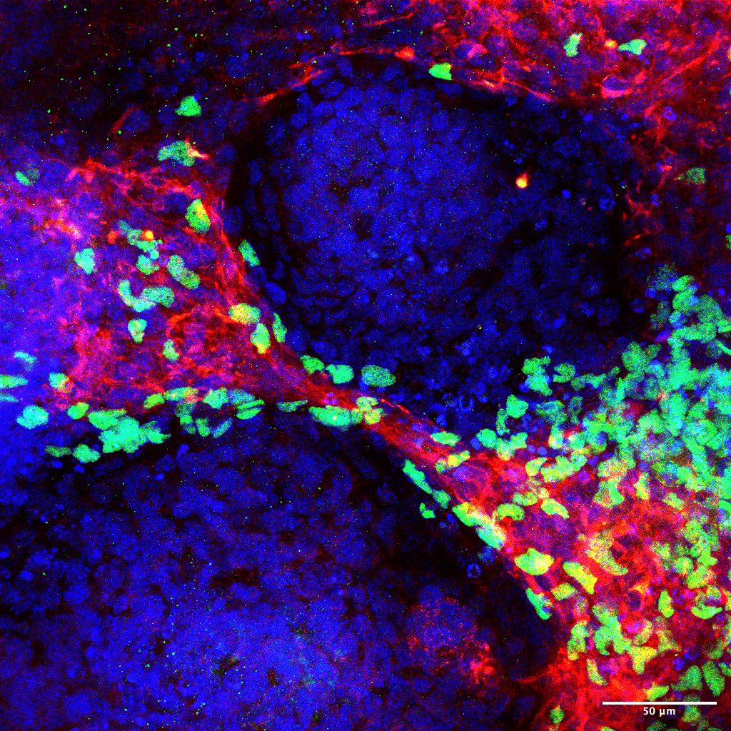 Neural crest cells in green (SOX10) migrating along red cardiomyocytes (TNNT2) in a developing heart organoid. Blue is cell nuclei.