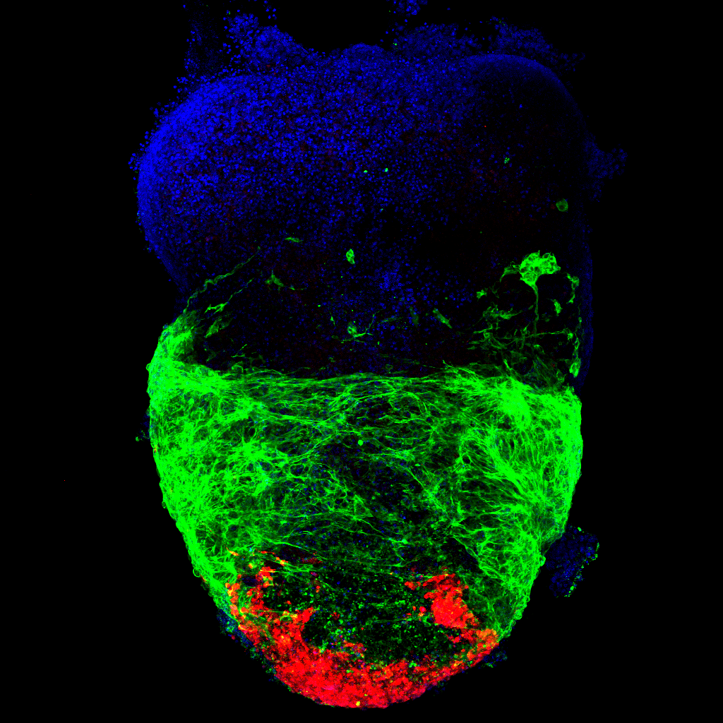 A heart organoid with a well-developed ventricle (green) and cardiac neural crest cells (mCherry) incorporating to the structure. Blue is cell nuclei.