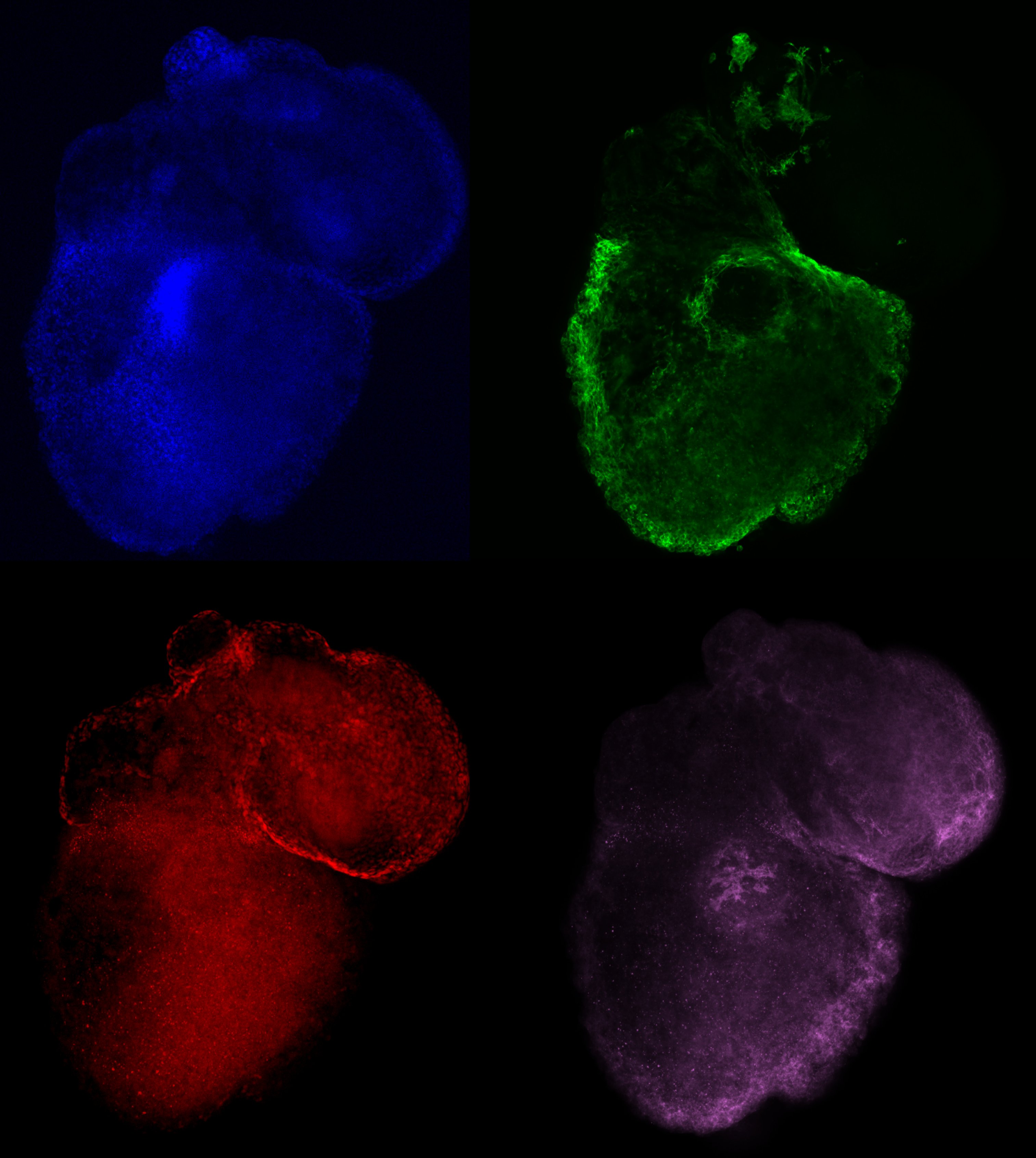 A heart organoid montage showing different parts of the heart in the same organoid – epicardium in red, myocardium in green, epithelial junctions in magenta and cell nuclei in blue.